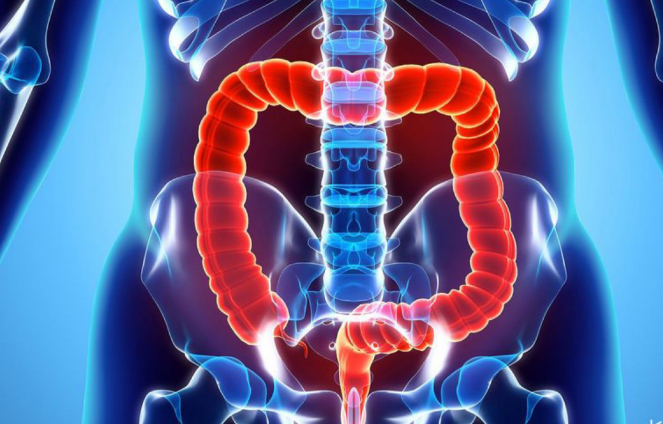 رتبه سوم استان یزد در ابتلا به سرطان روده بزرگ