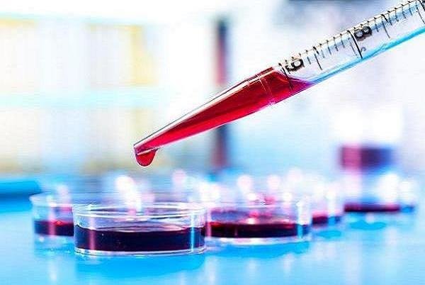 تشخیص آلزایمر با یک آزمایش ساده