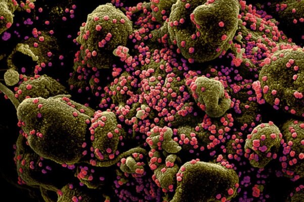 تست کرونای ۱۳ مورد جدید در کرمان مثبت شد