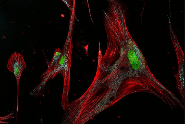 با دو روی سکه سلول‌های زامبی آشنا شوید